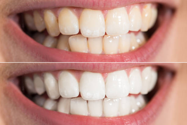 Dental Epping 